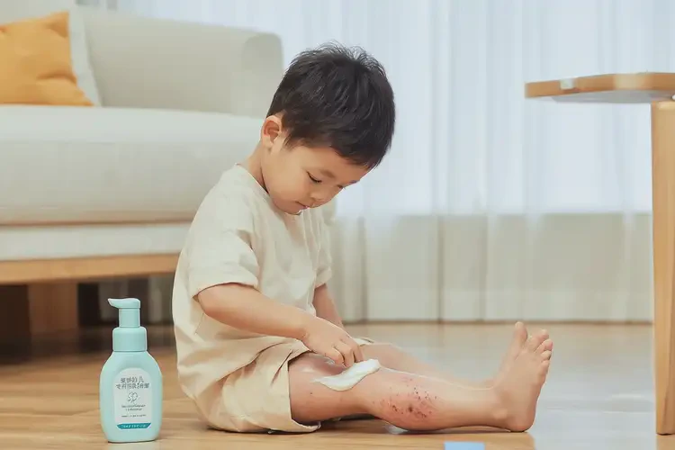 孩子大腿上容易起濕疹可不可以根治(圖2)