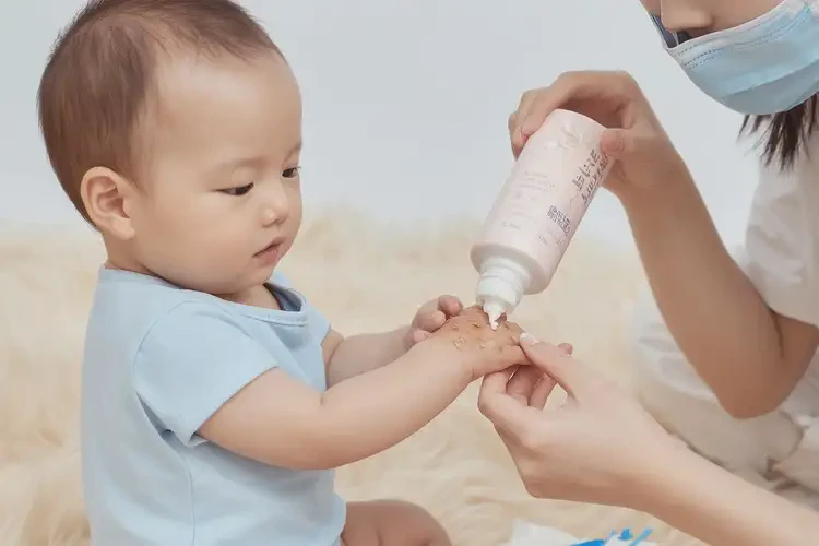 嬰兒手上容易起濕疹不管它會自己自愈嗎(圖3)
