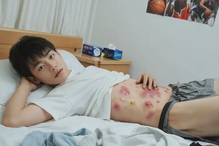 孩子肚子有濕疹可以徹底自愈嗎(圖2)