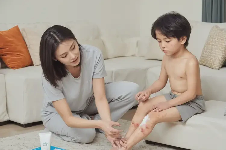 少兒小腿出濕疹不管它會(huì)自己自愈嗎(圖2)