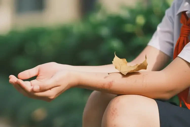 中學(xué)生手臂偶爾起濕疹可不可以根治(圖1)