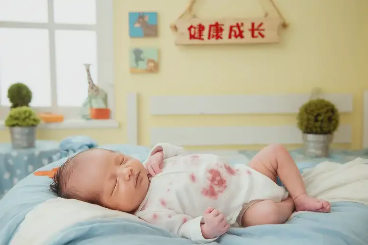 新生兒肚子起濕疹可不可以根治(圖4)