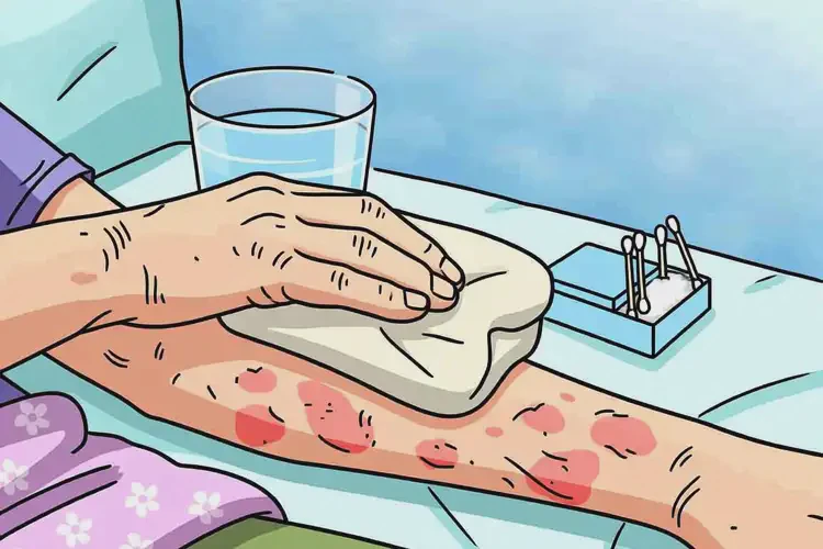 老人手臂上出現(xiàn)濕疹可不可以根治(圖2)