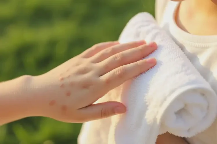 女生手上偶爾起濕疹可不可以根治(圖1)