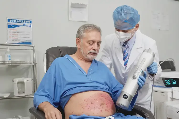 男性肚子出濕疹可不可以根治(圖1)