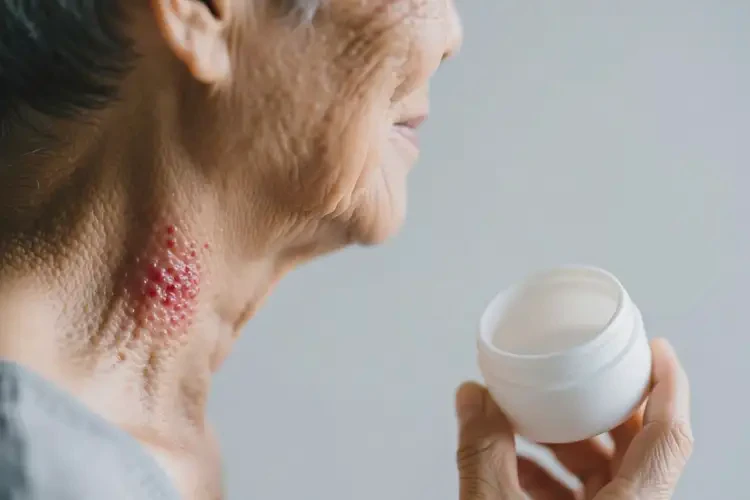 老年人脖子上长湿疹可不可以根治(图3)