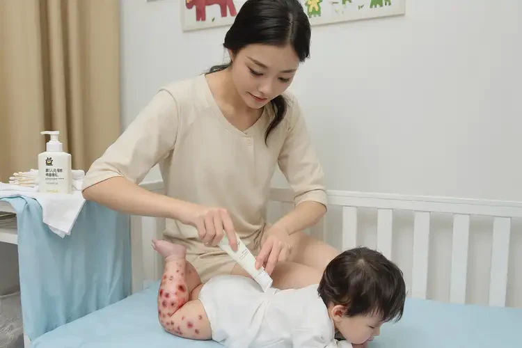 幼兒屁股偶爾長(zhǎng)濕疹可不可以根治(圖3)