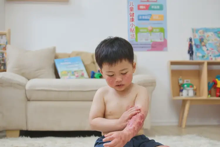 孩子全身经常长湿疹可不可以根治(图4)