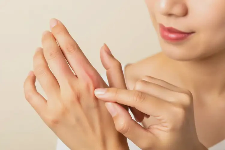 女性手上經(jīng)常起濕疹可不可以根治(圖4)