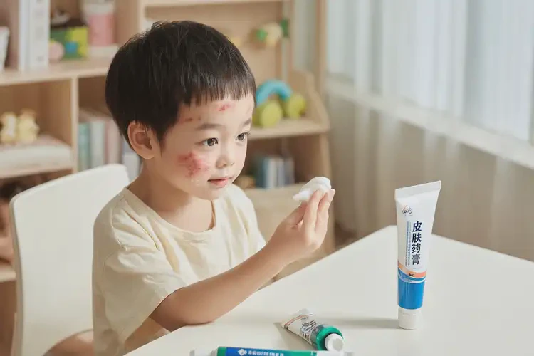 小孩面部出濕疹可不可以根治(圖2)