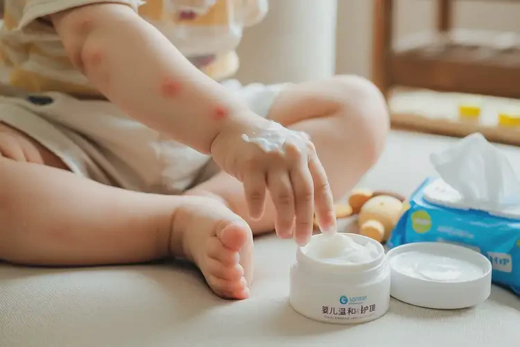 幼兒小腿上有濕疹不管它會(huì)自己痊愈嗎(圖3)