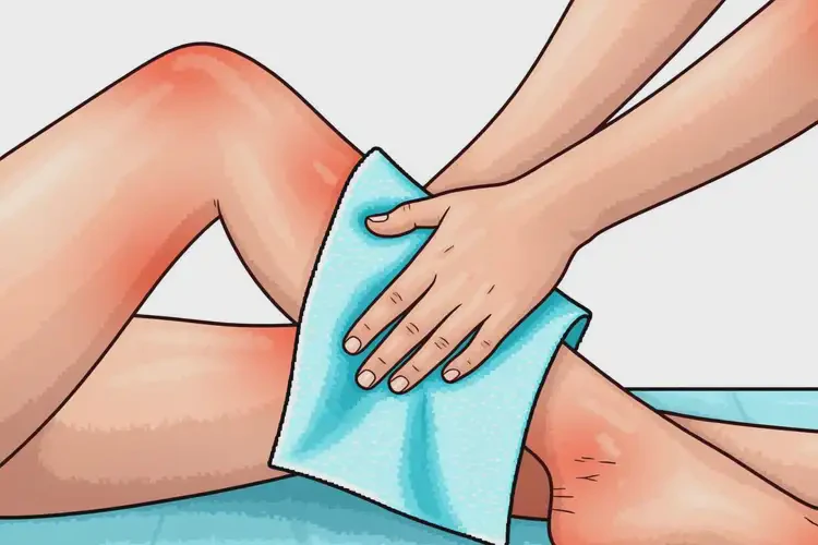 青少年大腿起濕疹可不可以根治(圖3)