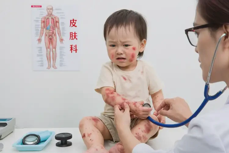 幼兒屁股上起濕疹可不可以根治(圖4)