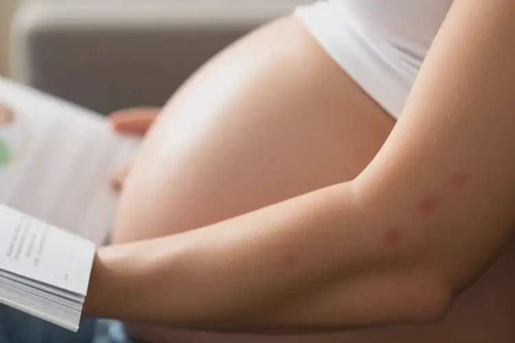 孕妇手臂上起湿疹可不可以根治(图2)