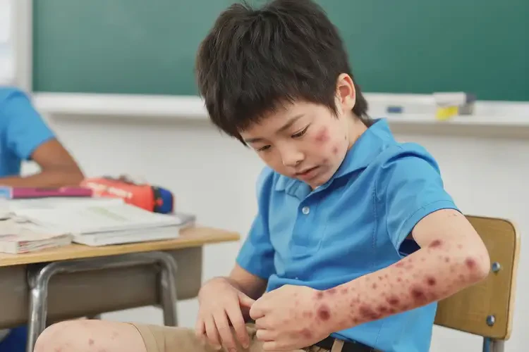 小學(xué)生四肢偶爾起濕疹可不可以根治(圖4)