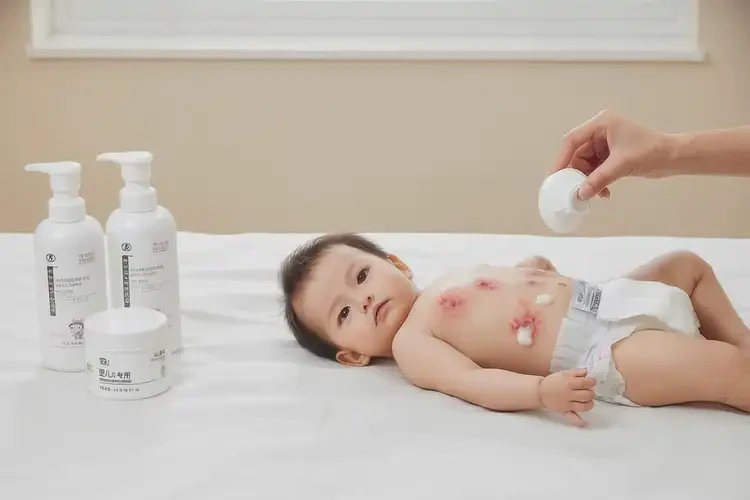 嬰兒肚子出現(xiàn)濕疹可以治好嗎(圖3)