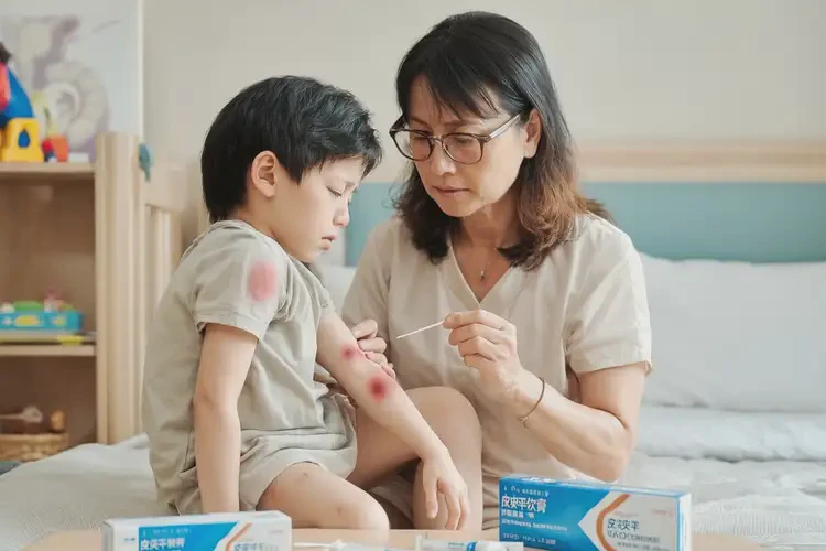 小孩全身偶爾長濕疹可不可以根治(圖3)