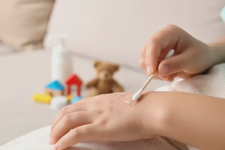 孩子手上容易起濕疹可不可以根治(圖4)