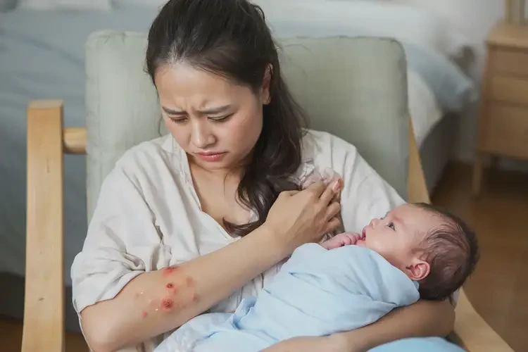 哺乳期媽媽屁股上有濕疹不管它會(huì)自己痊愈嗎(圖4)