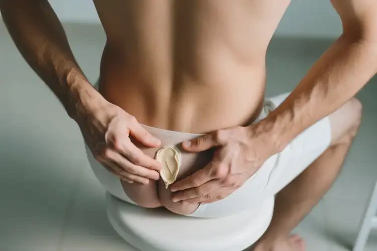 男人肛周容易起湿疹能不能根治(图3)