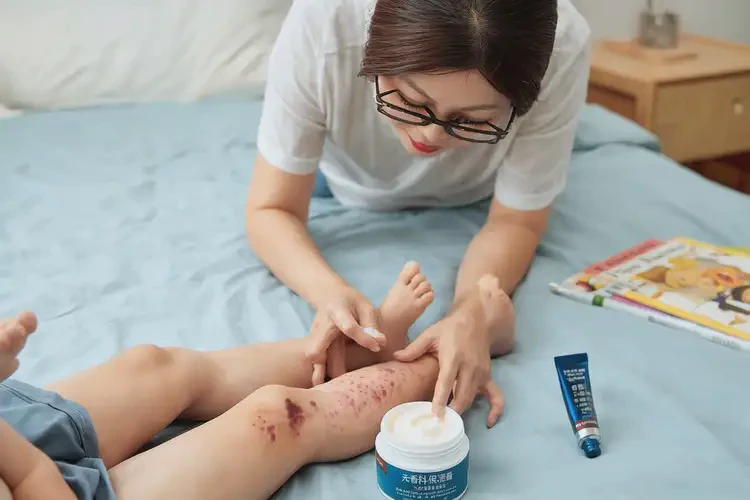 少兒小腿上偶爾長(zhǎng)濕疹能靠自己自愈嗎(圖3)