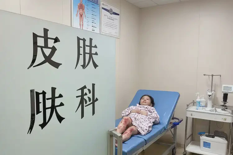 產(chǎn)婦大腿上長濕疹可不可以徹底自愈(圖2)