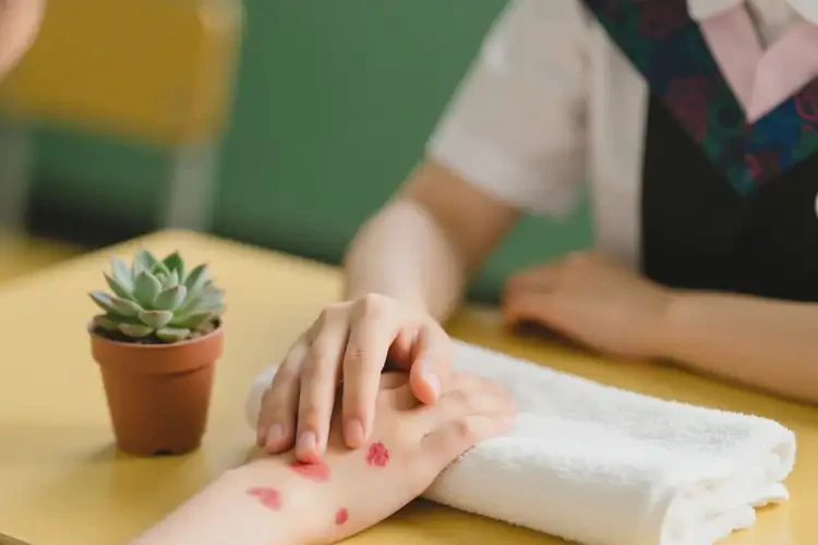 大學(xué)生身上經(jīng)常長濕疹可不可以根治(圖3)