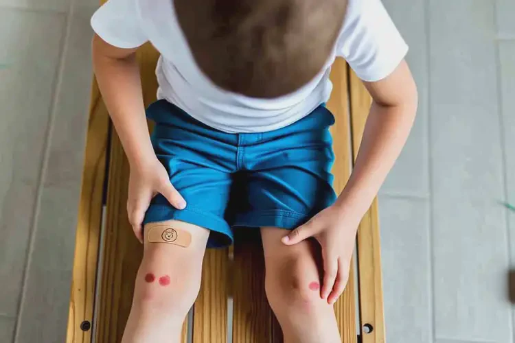 小學(xué)生四肢有濕疹可不可以根治(圖2)