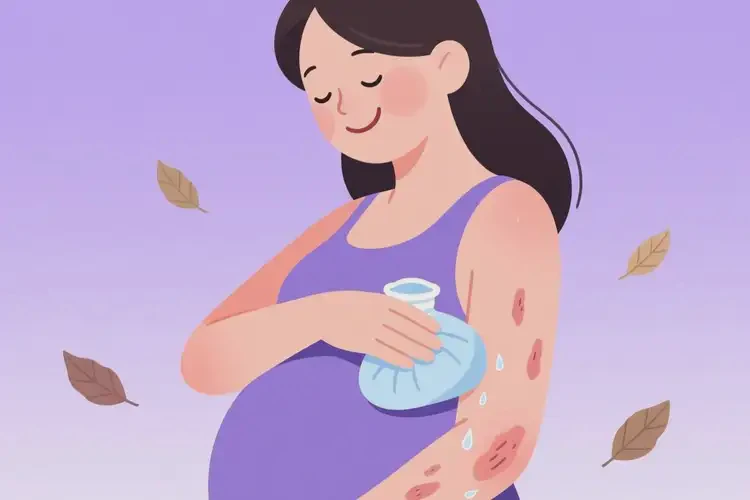 孕婦全身經(jīng)常起濕疹可不可以根治(圖1)