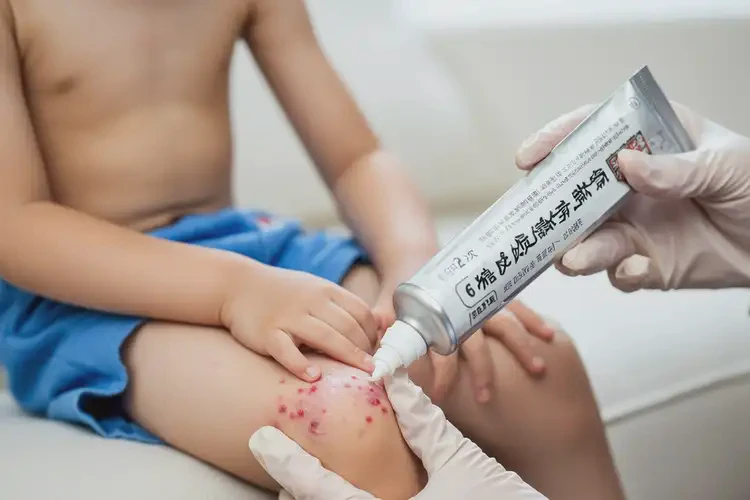 孩子大腿經常起濕疹可不可以根治(圖3)