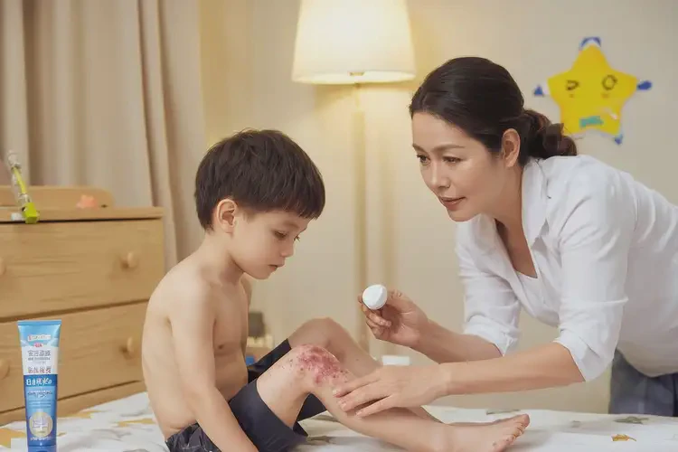 兒童小腿上偶爾起濕疹可不可以根治(圖3)