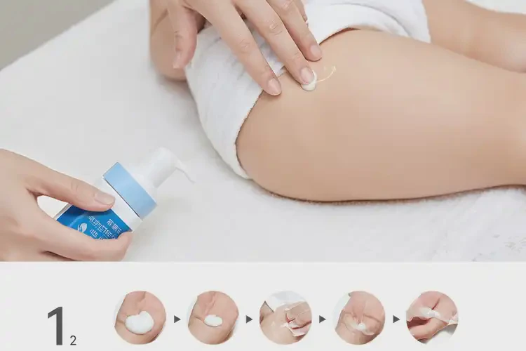 少兒屁股上經(jīng)常起濕疹可不可以根治(圖3)