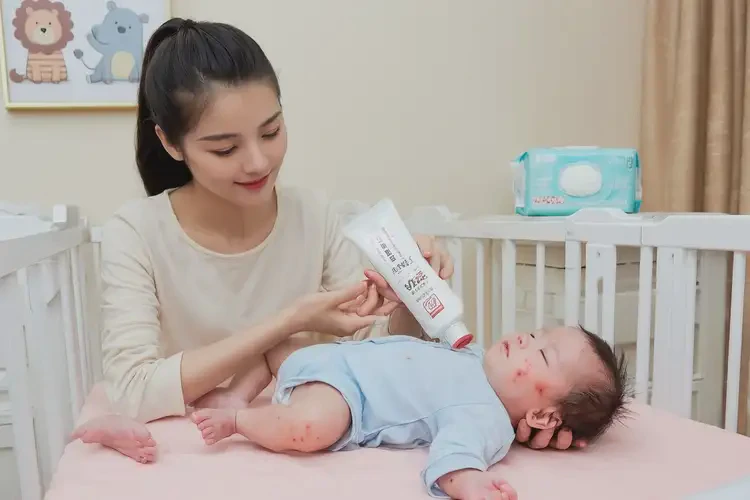 嬰幼兒脖子上起濕疹可不可以根治(圖2)