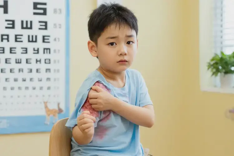 小孩肚子長濕疹可不可以徹底自愈(圖2)