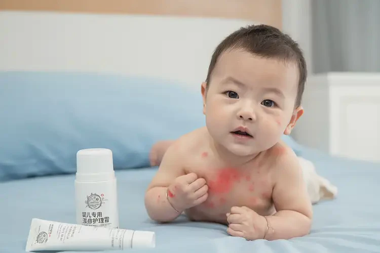 寶寶肚子上經(jīng)常起濕疹可不可以根治(圖4)
