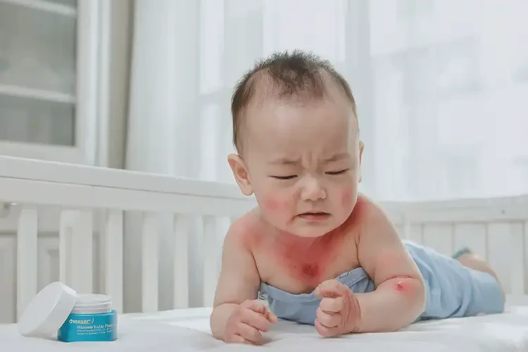 嬰兒脖子容易長(zhǎng)濕疹可不可以根治(圖4)