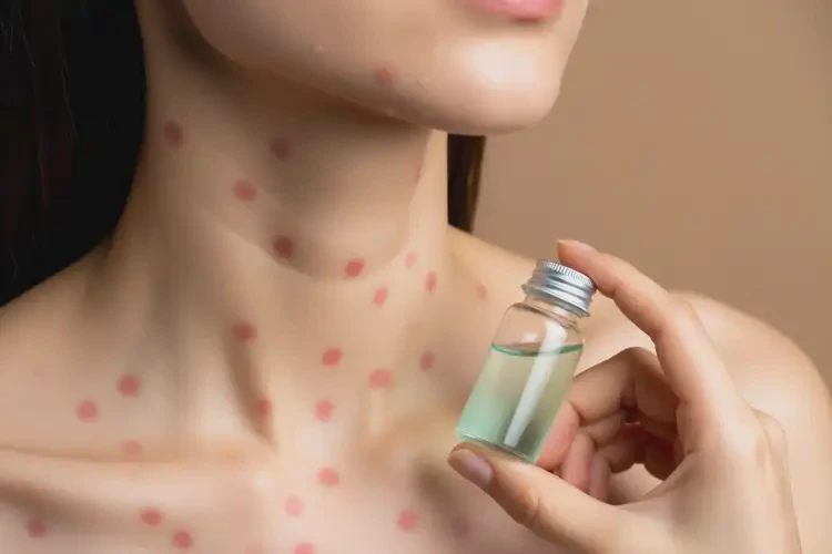 女性脖子長濕疹可不可以根治(圖1)