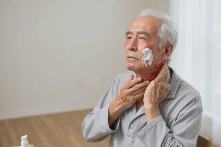 高齡老人脖子上偶爾起濕疹能不能根治(圖3)