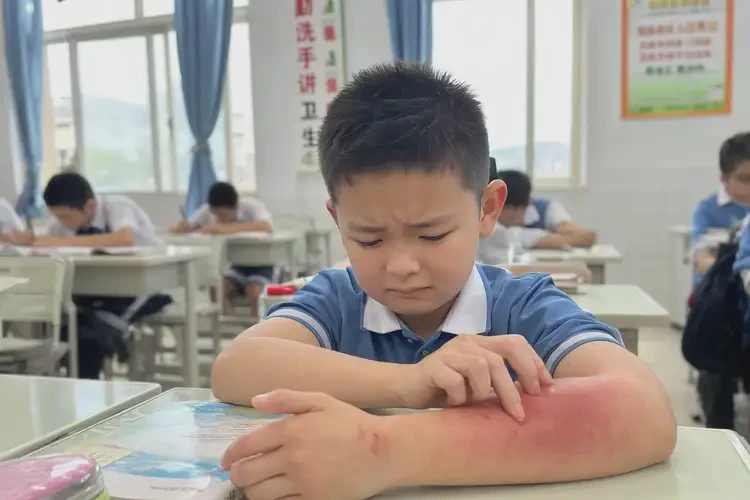 小學(xué)生屁股偶爾長濕疹可不可以根治(圖4)