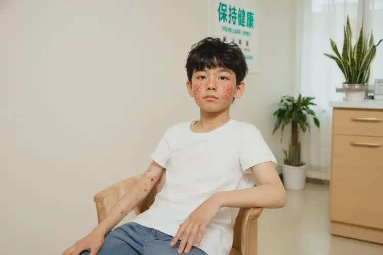 青少年屁股起濕疹可不可以根治(圖3)