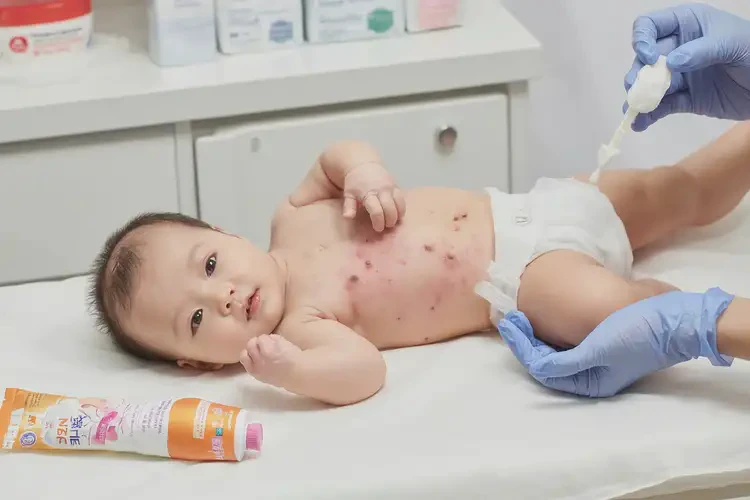 嬰兒肛周偶爾長濕疹可以治好嗎(圖4)