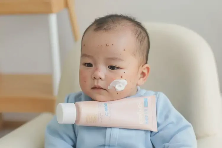 嬰兒脖子上長(zhǎng)濕疹可不可以根治(圖3)