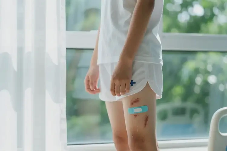 青少年大腿上长湿疹可不可以根治(图2)