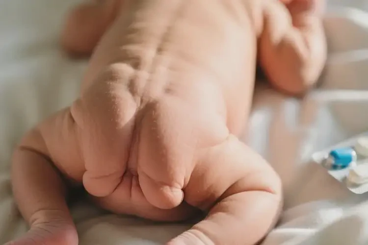 新生兒屁股上出濕疹可不可以根治(圖4)