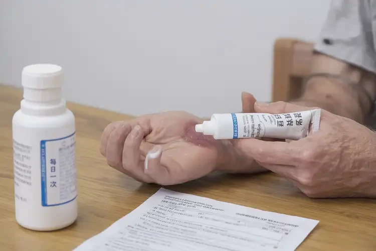 中學(xué)生身上有濕疹可不可以根治(圖4)