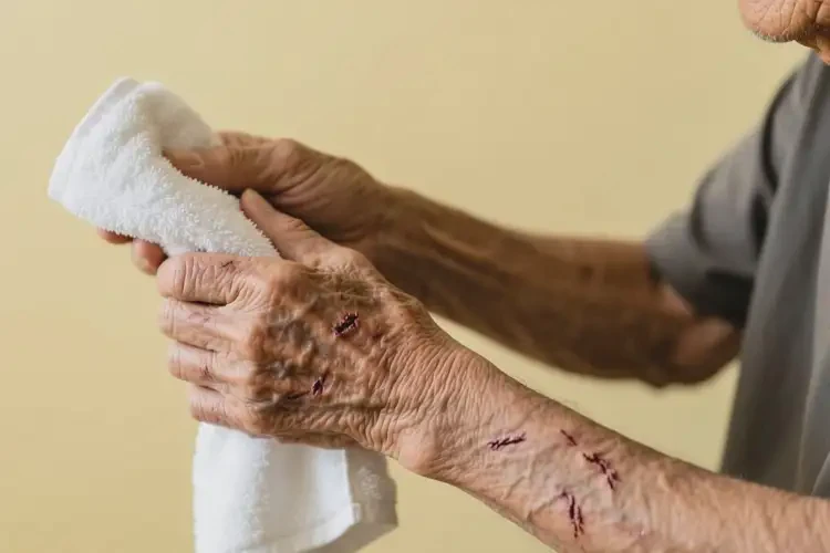 高齡老人四肢經(jīng)常起濕疹可不可以根治(圖1)