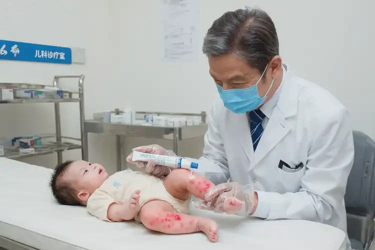 嬰兒小腿上起濕疹可以治好嗎(圖3)