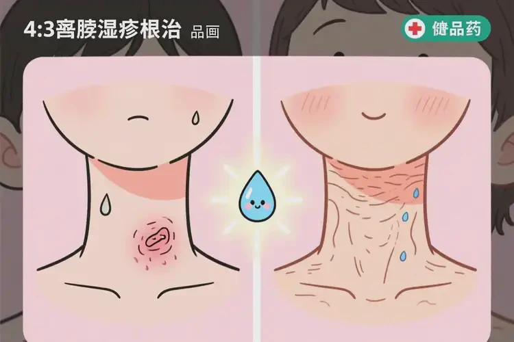 少兒脖子長濕疹可不可以根治(圖3)