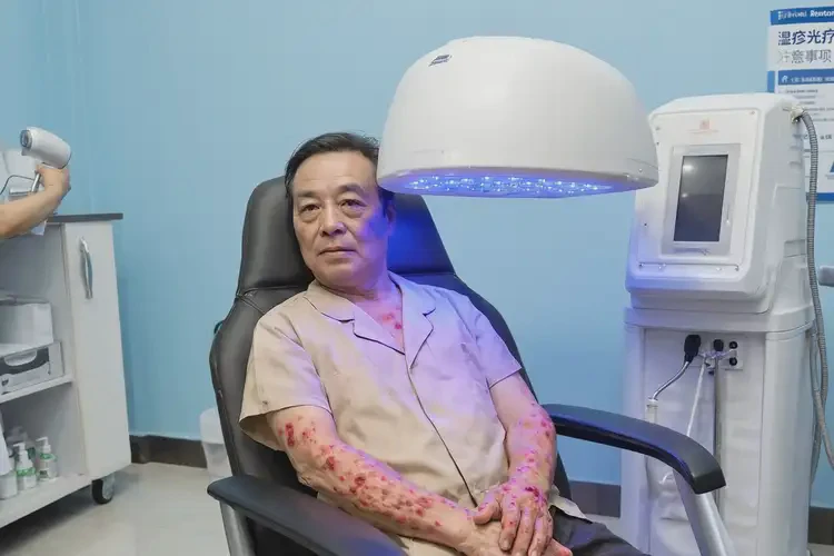 青年人手上偶尔长湿疹可不可以根治(图1)