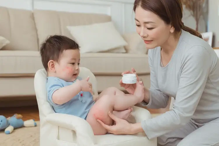 寶寶四肢偶爾起濕疹可不可以根治(圖3)